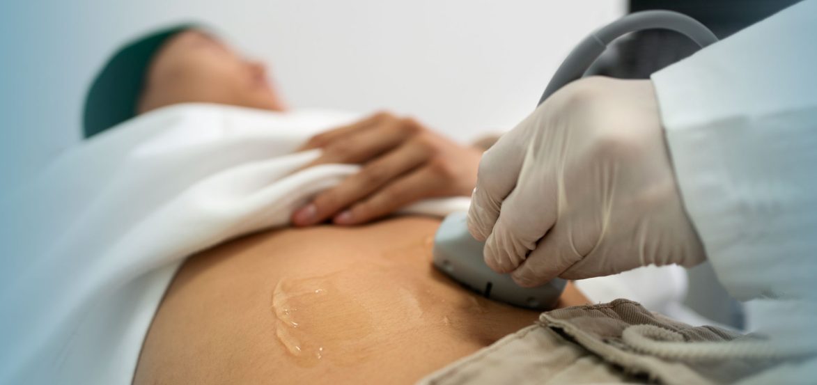 yperhxos-oyropoihtiko